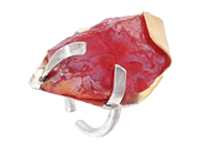 Jewellery, MANDELSTAM, ring, in auction: Lilla jewellery – Tuesday 2 December